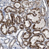 Anti-ILDR1 antibody produced in rabbit Prestige Antibodies® Powered by Atlas Antibodies, affinity isolated antibody, buffered aqueous glycerol solution