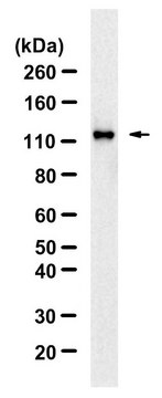 Anti-phospho-ULK1-Ser757 Antibody, clone 5L18 ZooMAb&#174; Rabbit Monoclonal recombinant, expressed in HEK 293 cells