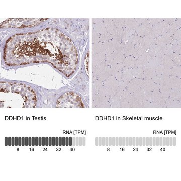 Anti-DDHD1 antibody produced in rabbit affinity isolated antibody, buffered aqueous glycerol solution