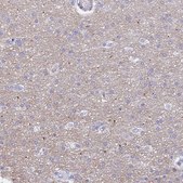Anti-HAPLN2 antibody produced in rabbit Prestige Antibodies® Powered by Atlas Antibodies, affinity isolated antibody, buffered aqueous glycerol solution