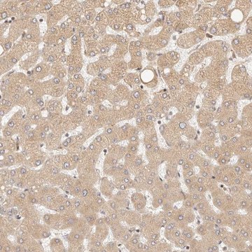 Anti-TIMM17A antibody produced in rabbit Prestige Antibodies&#174; Powered by Atlas Antibodies, affinity isolated antibody, buffered aqueous glycerol solution