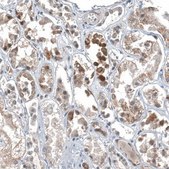 Anti-C1orf112 antibody produced in rabbit Prestige Antibodies® Powered by Atlas Antibodies, affinity isolated antibody, buffered aqueous glycerol solution, Ab2