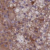 Anti-AMDHD2 antibody produced in rabbit Prestige Antibodies® Powered by Atlas Antibodies, affinity isolated antibody, buffered aqueous glycerol solution
