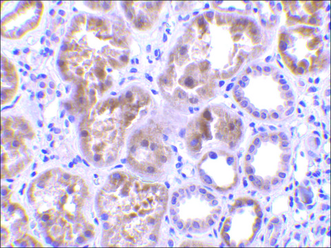 Anti-CTRP1 (ab2) antibody produced in rabbit affinity isolated antibody, buffered aqueous solution