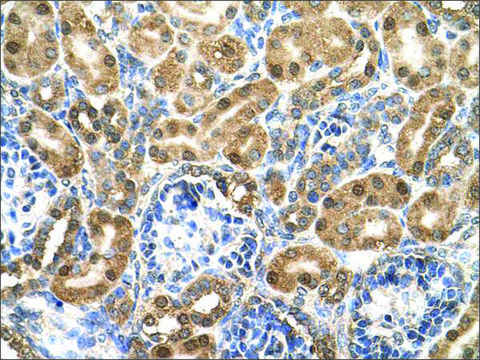 Anti-ENO3 (AB1) antibody produced in rabbit affinity isolated antibody