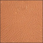 Human Osteoblasts-Rheumatoid Arthritis: HOb-RA, adult