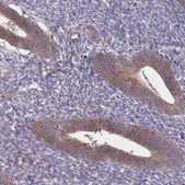 Anti-SLC9A6 antibody produced in rabbit Prestige Antibodies® Powered by Atlas Antibodies, affinity isolated antibody, buffered aqueous glycerol solution