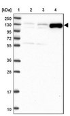 Anti-ADAMTS6 antibody produced in rabbit Prestige Antibodies® Powered by Atlas Antibodies, affinity isolated antibody, buffered aqueous glycerol solution