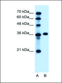 Anti-PTCH1 antibody produced in rabbit affinity isolated antibody