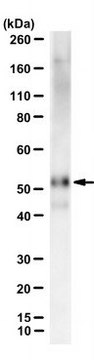 Anti-&#945;-Parvin/PARVA Antibody, clone 3B5