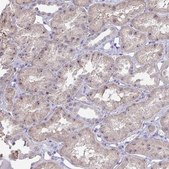 Anti-MYC antibody produced in rabbit Prestige Antibodies® Powered by Atlas Antibodies, affinity isolated antibody, buffered aqueous glycerol solution