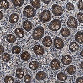 Anti-GGCT antibody produced in rabbit Prestige Antibodies® Powered by Atlas Antibodies, affinity isolated antibody, buffered aqueous glycerol solution