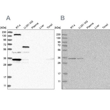 Anti-PPP1R42 antibody produced in rabbit Prestige Antibodies® Powered by Atlas Antibodies, affinity isolated antibody, buffered aqueous glycerol solution, ab2