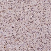 Anti-PRRX1 antibody produced in rabbit Prestige Antibodies® Powered by Atlas Antibodies, affinity isolated antibody, buffered aqueous glycerol solution
