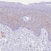 Anti-TMEM79 antibody produced in rabbit Prestige Antibodies® Powered by Atlas Antibodies, affinity isolated antibody, buffered aqueous glycerol solution