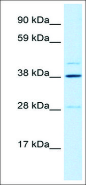 Anti-LASS3 antibody produced in rabbit affinity isolated antibody