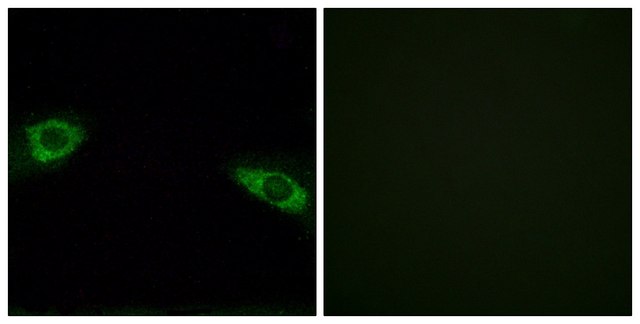 Anti-RPS4Y1 antibody produced in rabbit affinity isolated antibody