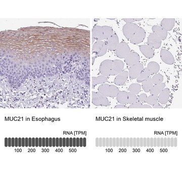 Anti-MUC21 antibody produced in rabbit Prestige Antibodies&#174; Powered by Atlas Antibodies, affinity isolated antibody, buffered aqueous glycerol solution