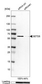 Anti-SETD5 antibody produced in rabbit Prestige Antibodies® Powered by Atlas Antibodies, affinity isolated antibody, buffered aqueous glycerol solution