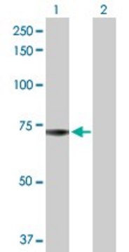 Anti-ADCK2 antibody produced in rabbit purified immunoglobulin, buffered aqueous solution