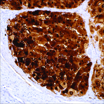 Arginase-1 (SP156) Rabbit Monoclonal Antibody