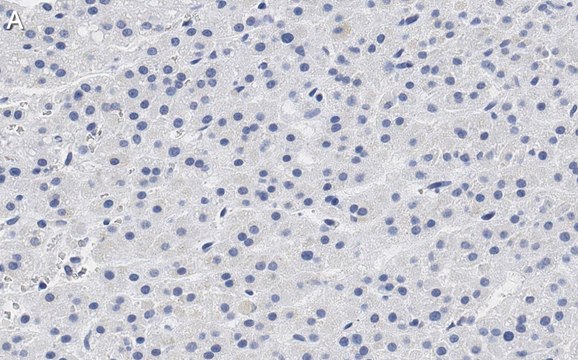 Anti-CXCR4 Antibody, clone 2L2, ZooMAb&#174; Rabbit Monoclonal recombinant, expressed in HEK 293 cells