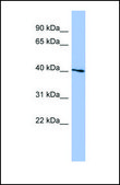 Anti-SGK1 antibody produced in rabbit affinity isolated antibody