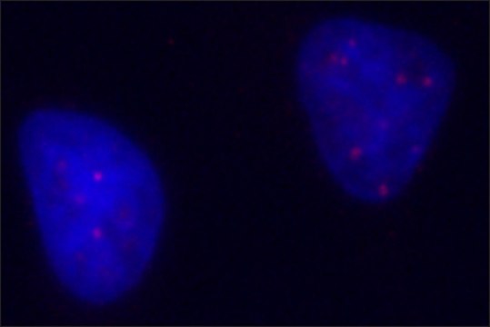 Anti-PML antibody, Mouse monoclonal clone PML-97, purified from hybridoma cell culture