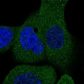Anti-STRIP2 antibody produced in rabbit Prestige Antibodies® Powered by Atlas Antibodies, affinity isolated antibody, buffered aqueous glycerol solution
