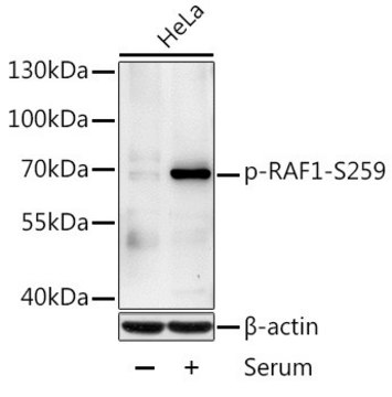 Anti-Phospho-RAF1-S259 antibody produced in rabbit