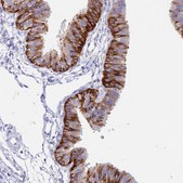 Anti-NLRP12 antibody produced in rabbit Prestige Antibodies® Powered by Atlas Antibodies, affinity isolated antibody, buffered aqueous glycerol solution