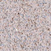 Monoclonal Anti-POSTN antibody produced in mouse Prestige Antibodies® Powered by Atlas Antibodies, clone CL12087, purified immunoglobulin, buffered aqueous glycerol solution