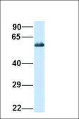 Anti-CD36 affinity isolated antibody