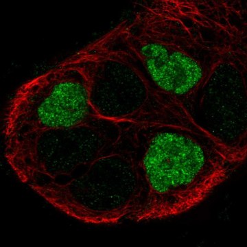 Anti-GPR161 antibody produced in rabbit Prestige Antibodies&#174; Powered by Atlas Antibodies, affinity isolated antibody