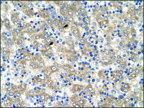 Anti-TSPAN32 (AB2) antibody produced in rabbit IgG fraction of antiserum