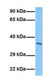 Anti-PARP16 antibody produced in rabbit affinity isolated antibody