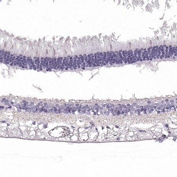 Anti-SLC1A7 antibody produced in rabbit Prestige Antibodies&#174; Powered by Atlas Antibodies, affinity isolated antibody, buffered aqueous glycerol solution