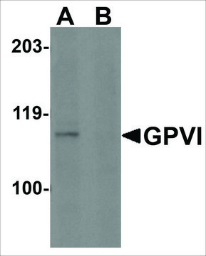 Anti-GPVI (ab2) antibody produced in rabbit affinity isolated antibody, buffered aqueous solution