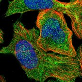 Anti-SSH3 antibody produced in rabbit Prestige Antibodies® Powered by Atlas Antibodies, affinity isolated antibody, buffered aqueous glycerol solution, Ab1
