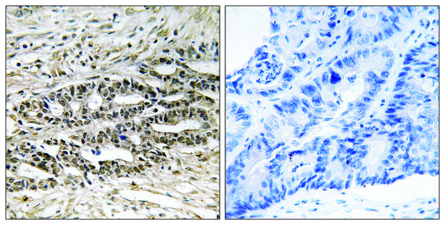 Anti-MDM4 antibody produced in rabbit affinity isolated antibody