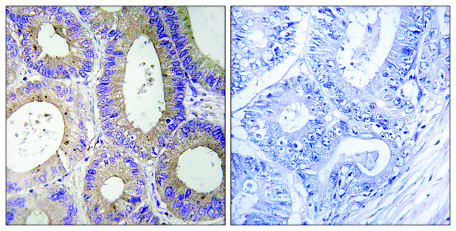 Anti-CBR3 antibody produced in rabbit affinity isolated antibody