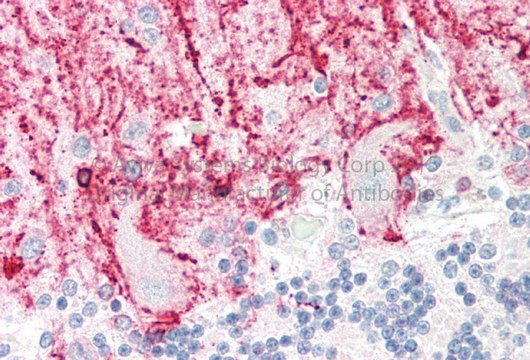 Anti-RCAN1 (N-terminal) antibody produced in rabbit affinity isolated antibody