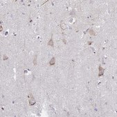 Anti-HTR2A antibody produced in rabbit Prestige Antibodies® Powered by Atlas Antibodies, affinity isolated antibody, buffered aqueous glycerol solution