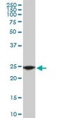 Monoclonal Anti-RPL19 antibody produced in mouse clone 3H4, purified immunoglobulin, buffered aqueous solution