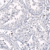 Monoclonal Anti-HLA-DRA antibody produced in mouse Prestige Antibodies® Powered by Atlas Antibodies, clone CL10964, purified antibody (Protein A)