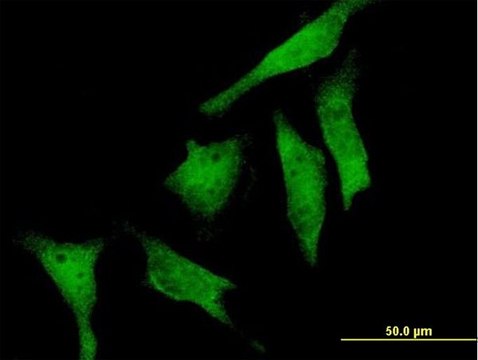 Anti-RIOK2 antibody produced in mouse purified immunoglobulin, buffered aqueous solution