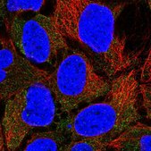 Anti-CLCN2 antibody produced in rabbit Prestige Antibodies® Powered by Atlas Antibodies, affinity isolated antibody, buffered aqueous glycerol solution