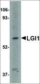 Anti-LGI1 (ab1) antibody produced in rabbit affinity isolated antibody, buffered aqueous solution