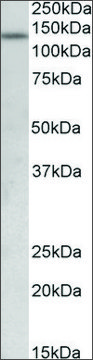 Anti-KDM2A antibody produced in goat affinity isolated antibody, buffered aqueous solution