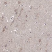 Anti-KCNJ9 antibody produced in rabbit Prestige Antibodies® Powered by Atlas Antibodies, affinity isolated antibody